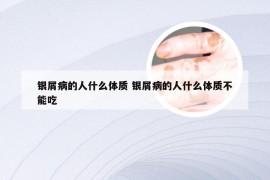银屑病的人什么体质 银屑病的人什么体质不能吃