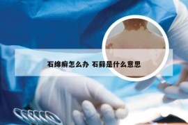 石绵癣怎么办 石藓是什么意思