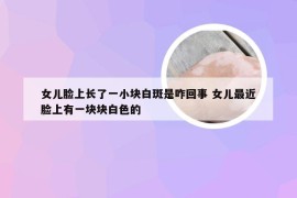 女儿脸上长了一小块白斑是咋回事 女儿最近脸上有一块块白色的