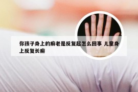 你孩子身上的癣老是反复起怎么回事 儿童身上反复长癣