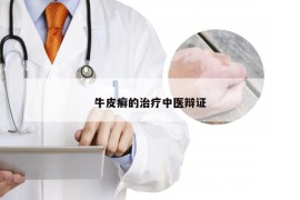 牛皮癣的治疗中医辩证