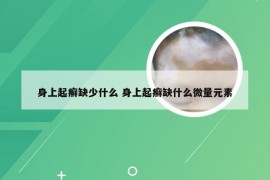 身上起癣缺少什么 身上起癣缺什么微量元素