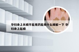 孕妇身上长癣不能用药能用什么缓解一下 孕妇身上起癣