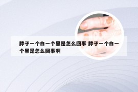 脖子一个白一个黑是怎么回事 脖子一个白一个黑是怎么回事啊