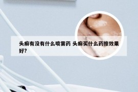 头癣有没有什么喷雾药 头癣买什么药擦效果好?