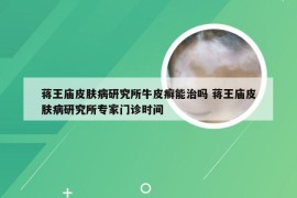 蒋王庙皮肤病研究所牛皮癣能治吗 蒋王庙皮肤病研究所专家门诊时间
