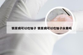 银屑病可以吃柚子 银屑病可以吃柚子水果吗