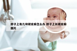 脖子上有几块硬皮癣怎么办 脖子上长硬皮癣图片