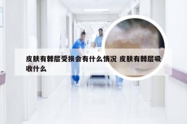 皮肤有棘层受损会有什么情况 皮肤有棘层吸收什么