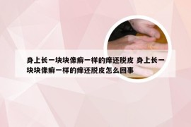 身上长一块块像癣一样的痒还脱皮 身上长一块块像癣一样的痒还脱皮怎么回事