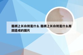 胳膊上长白斑是什么 胳膊上长白斑是什么原因造成的图片