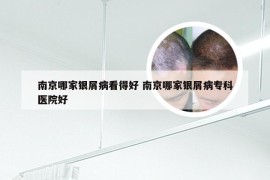 南京哪家银屑病看得好 南京哪家银屑病专科医院好