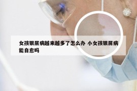 女孩银屑病越来越多了怎么办 小女孩银屑病能自愈吗