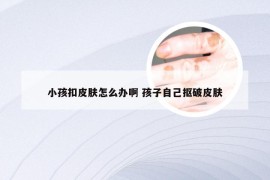 小孩扣皮肤怎么办啊 孩子自己抠破皮肤