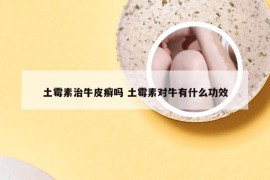 土霉素治牛皮癣吗 土霉素对牛有什么功效