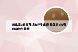 维生素a软膏可以治疗牛皮癣 维生素a软膏的功效与作用
