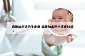麻黄加术汤治牛皮癣 麻黄加术汤治疗皮肤病ⅰ
