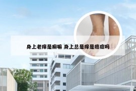 身上老痒是癣嘛 身上总是痒是癌症吗