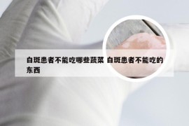 白斑患者不能吃哪些蔬菜 白斑患者不能吃的东西