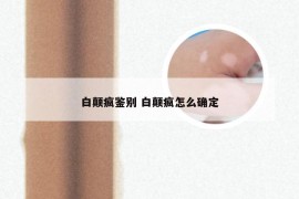 白颠疯鉴别 白颠疯怎么确定