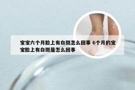 宝宝六个月脸上有白斑怎么回事 6个月的宝宝脸上有白斑是怎么回事