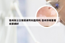 宿州有公立银屑病专科医院吗 宿州市哪里看皮肤病好