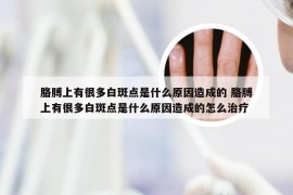 胳膊上有很多白斑点是什么原因造成的 胳膊上有很多白斑点是什么原因造成的怎么治疗