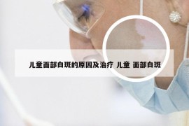 儿童面部白斑的原因及治疗 儿童 面部白斑