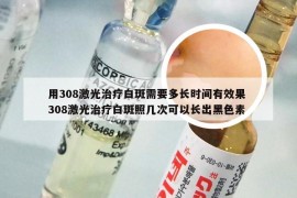 用308激光治疗白斑需要多长时间有效果 308激光治疗白斑照几次可以长出黑色素