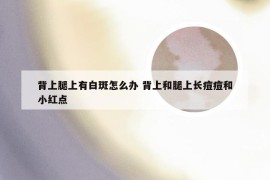 背上腿上有白斑怎么办 背上和腿上长痘痘和小红点