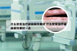 什么软膏治疗顽固癣效果好 什么软膏治疗顽固癣效果好一点