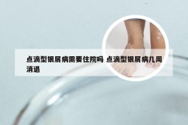 点滴型银屑病需要住院吗 点滴型银屑病几周消退