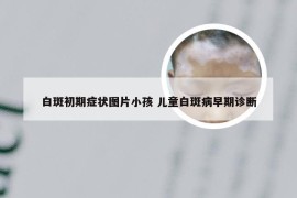 白斑初期症状图片小孩 儿童白斑病早期诊断