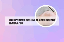 银削病中国协和医院问诊 北京协和医院的银屑病联合门诊