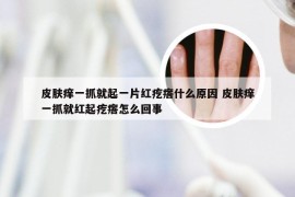 皮肤痒一抓就起一片红疙瘩什么原因 皮肤痒一抓就红起疙瘩怎么回事