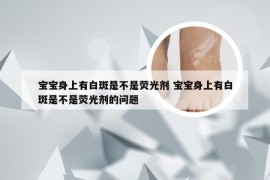 宝宝身上有白斑是不是荧光剂 宝宝身上有白斑是不是荧光剂的问题