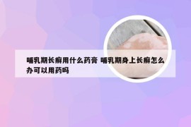 哺乳期长癣用什么药膏 哺乳期身上长癣怎么办可以用药吗