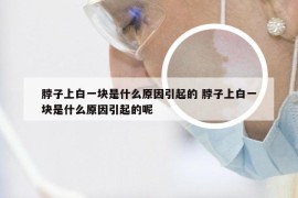 脖子上白一块是什么原因引起的 脖子上白一块是什么原因引起的呢