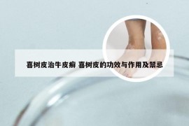喜树皮治牛皮癣 喜树皮的功效与作用及禁忌