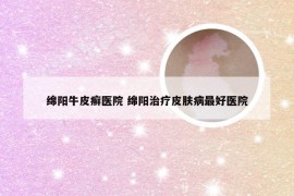 绵阳牛皮癣医院 绵阳治疗皮肤病最好医院