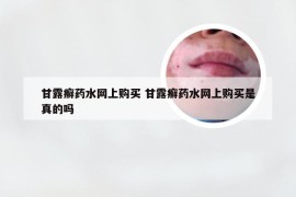 甘露癣药水网上购买 甘露癣药水网上购买是真的吗