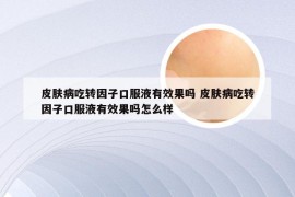 皮肤病吃转因子口服液有效果吗 皮肤病吃转因子口服液有效果吗怎么样