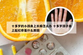 十多岁的小孩身上长癣怎么办 十多岁孩子身上起红疹是什么原因