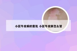 小区牛皮癣的害处 小区牛皮鲜怎么管