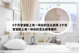 8个月宝宝脸上有一块白的怎么回事 8个月宝宝脸上有一块白的怎么回事图片
