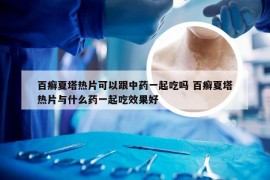 百癣夏塔热片可以跟中药一起吃吗 百癣夏塔热片与什么药一起吃效果好