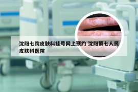 沈阳七院皮肤科挂号网上预约 沈阳第七人民皮肤科医院