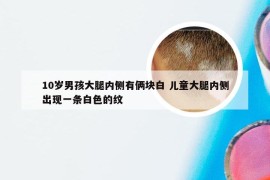 10岁男孩大腿内侧有俩块白 儿童大腿内侧出现一条白色的纹