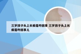 三岁孩子头上长癣是咋回事 三岁孩子头上长癣是咋回事儿