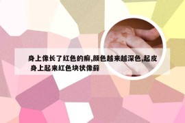 身上像长了红色的癣,颜色越来越深色,起皮 身上起来红色块状像藓
